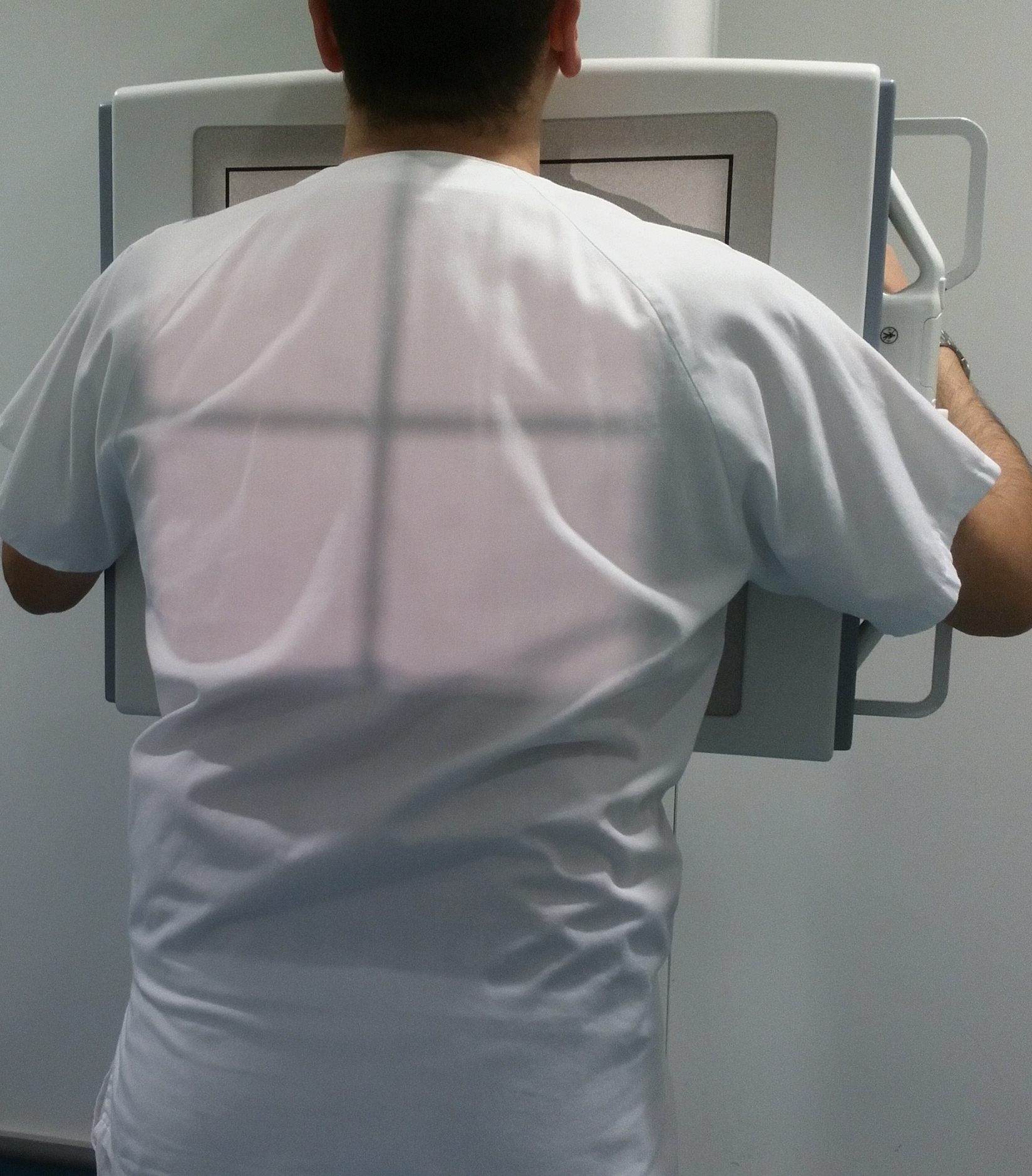 Radiografía AP Tórax